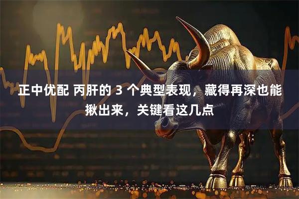正中优配 丙肝的 3 个典型表现，藏得再深也能揪出来，关键看这几点